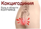 Правка копчика, кокцигодиния, коррекция копчика